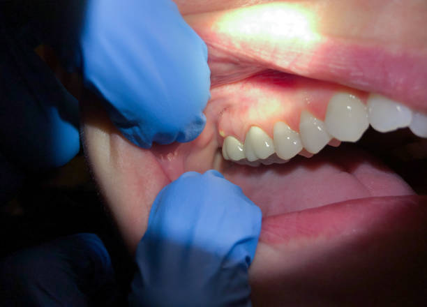 Best Emergency TMJ Treatment in Williamsport, PA