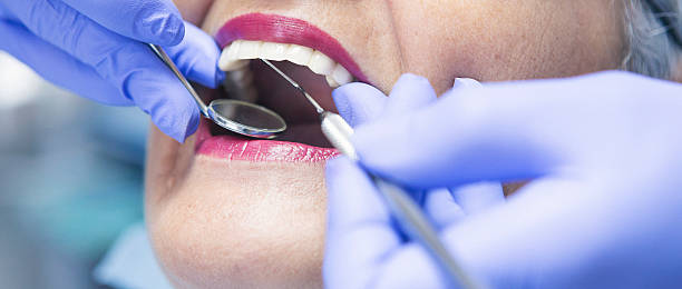 Best Emergency Treatment for Dental Infections or Abscesses in Williamsport, PA
